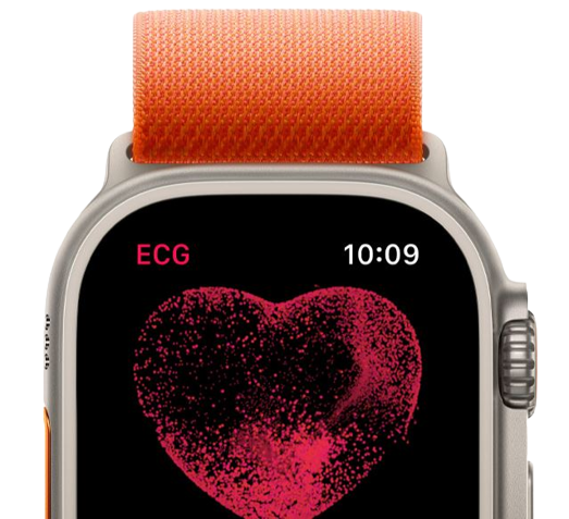 Apple Watch Ultra [GPS + Cellular 49mm] Smart Watch w/Rugged Titanium Case  & Yellow Ocean Band. 
